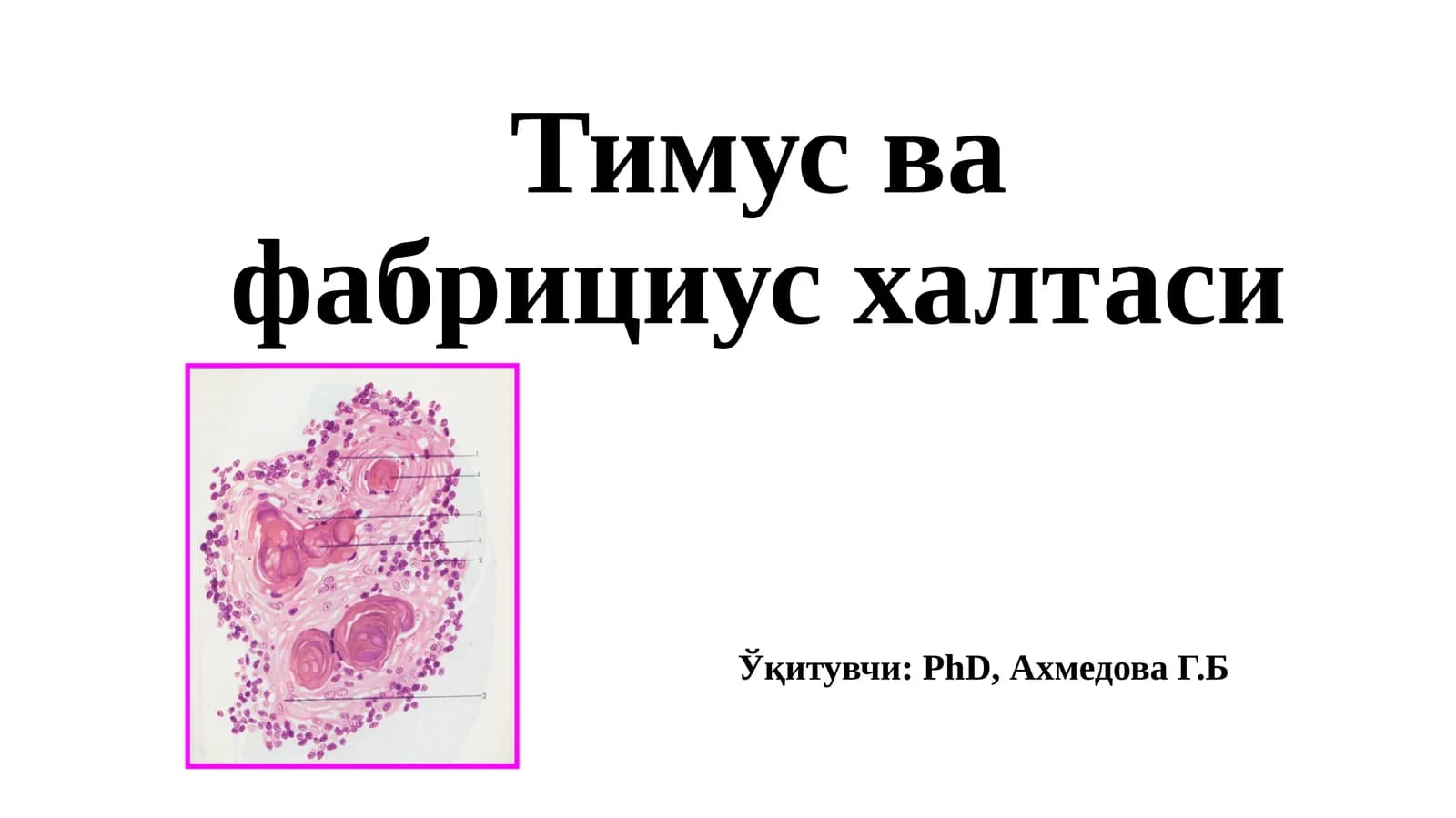 Тимус вафабрицияси
