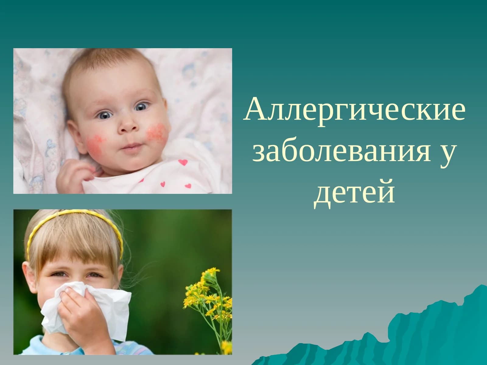 Аллергические заболевания у детей