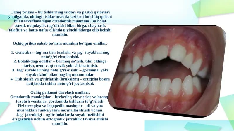 Ochiq prikus muammosi