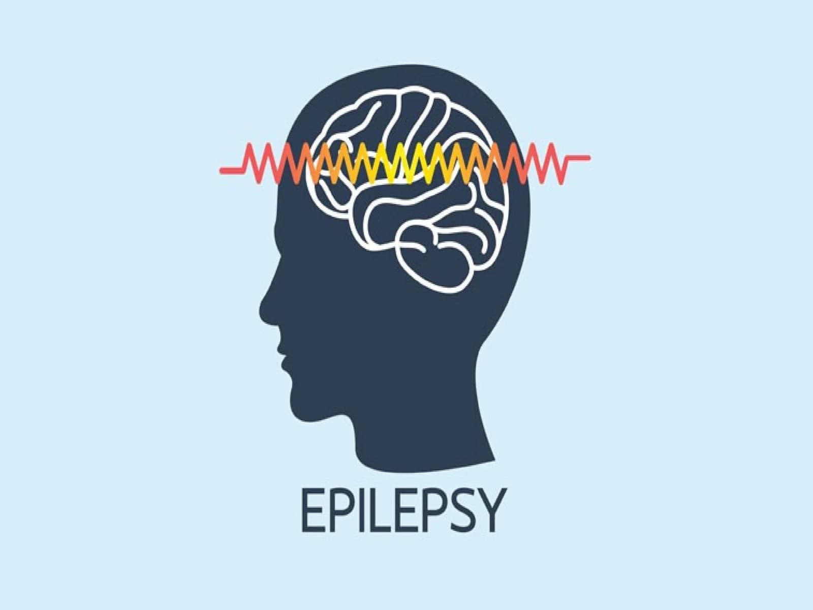 Epilepsiya