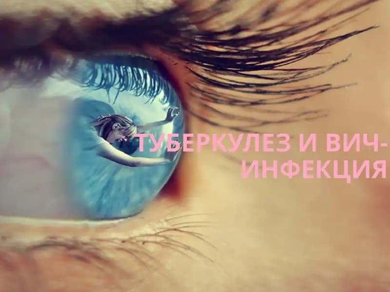 Туберкулез и ВИЧ-инфекция