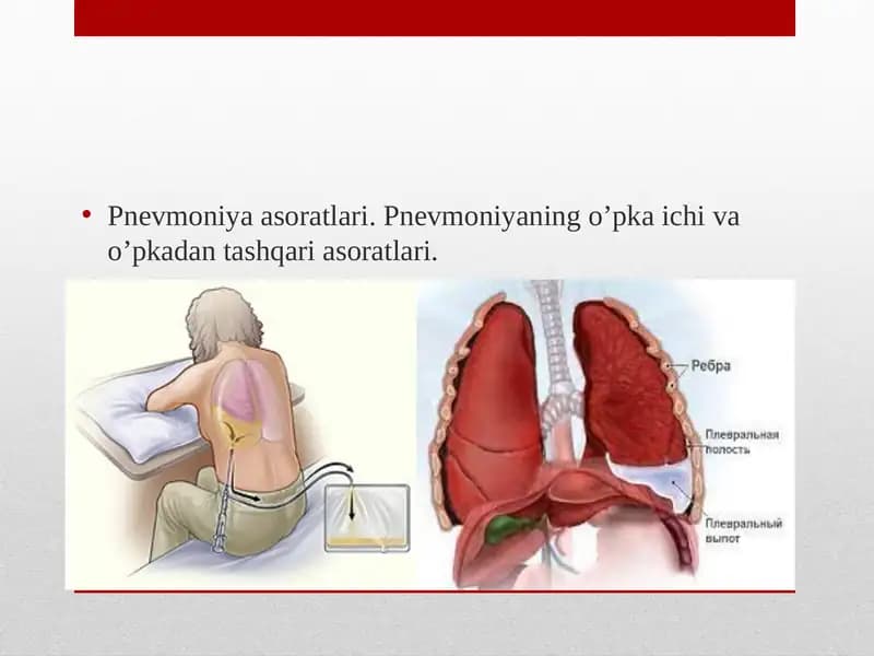 Pnevmoniya Asoratlari