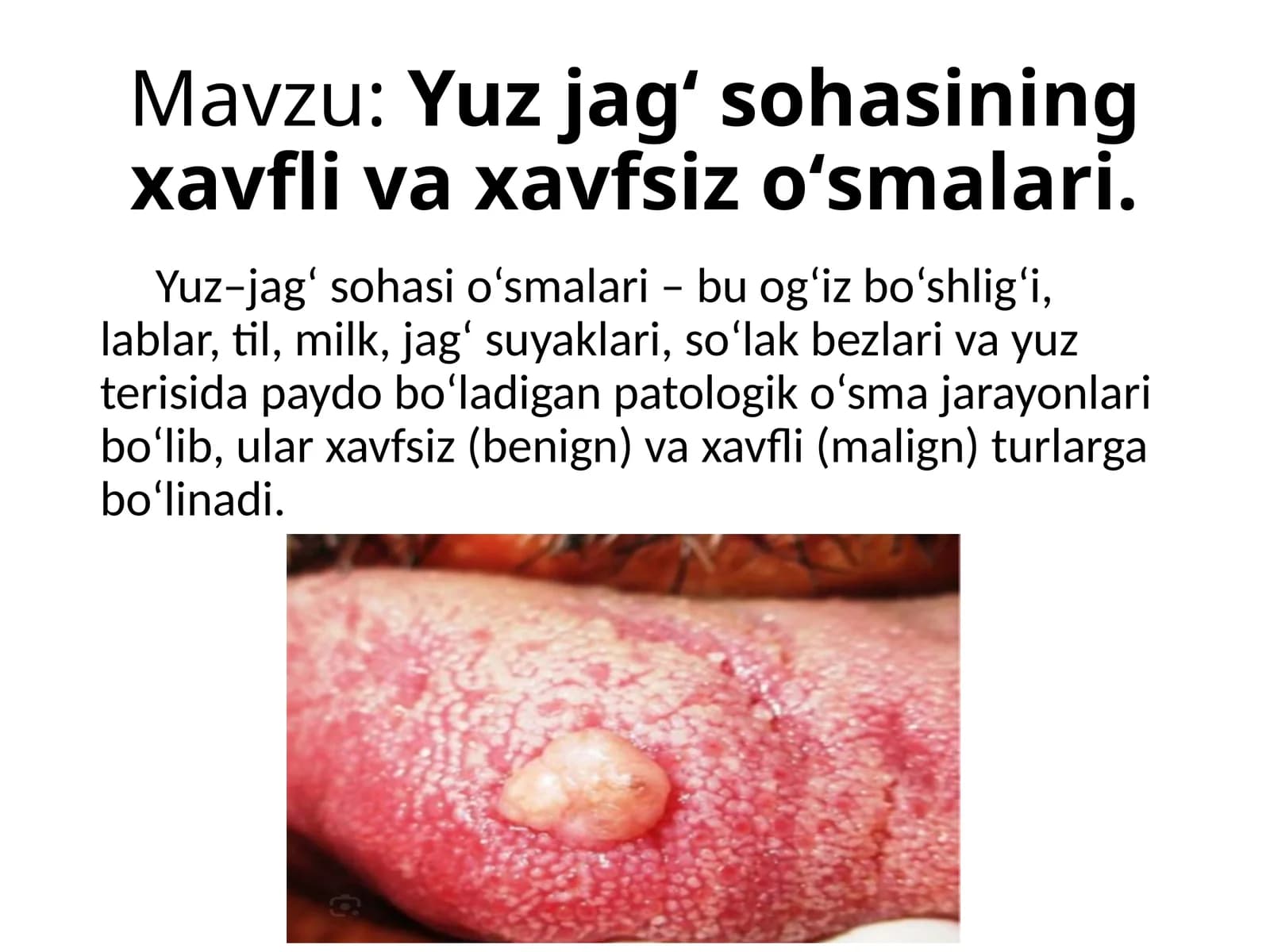 Yuz-jagʻ sohasining xavfli va xavfsiz oʻsmalari