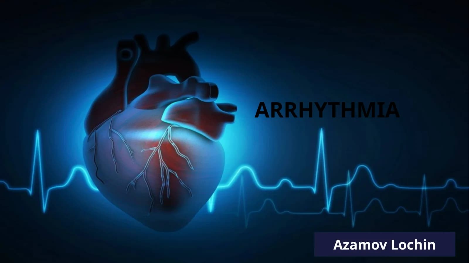 Supraventricular arrhythmia