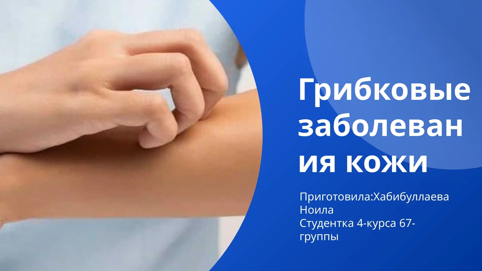 Грибковые заболевания кожи