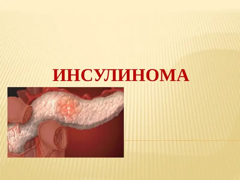 INSULINOMA