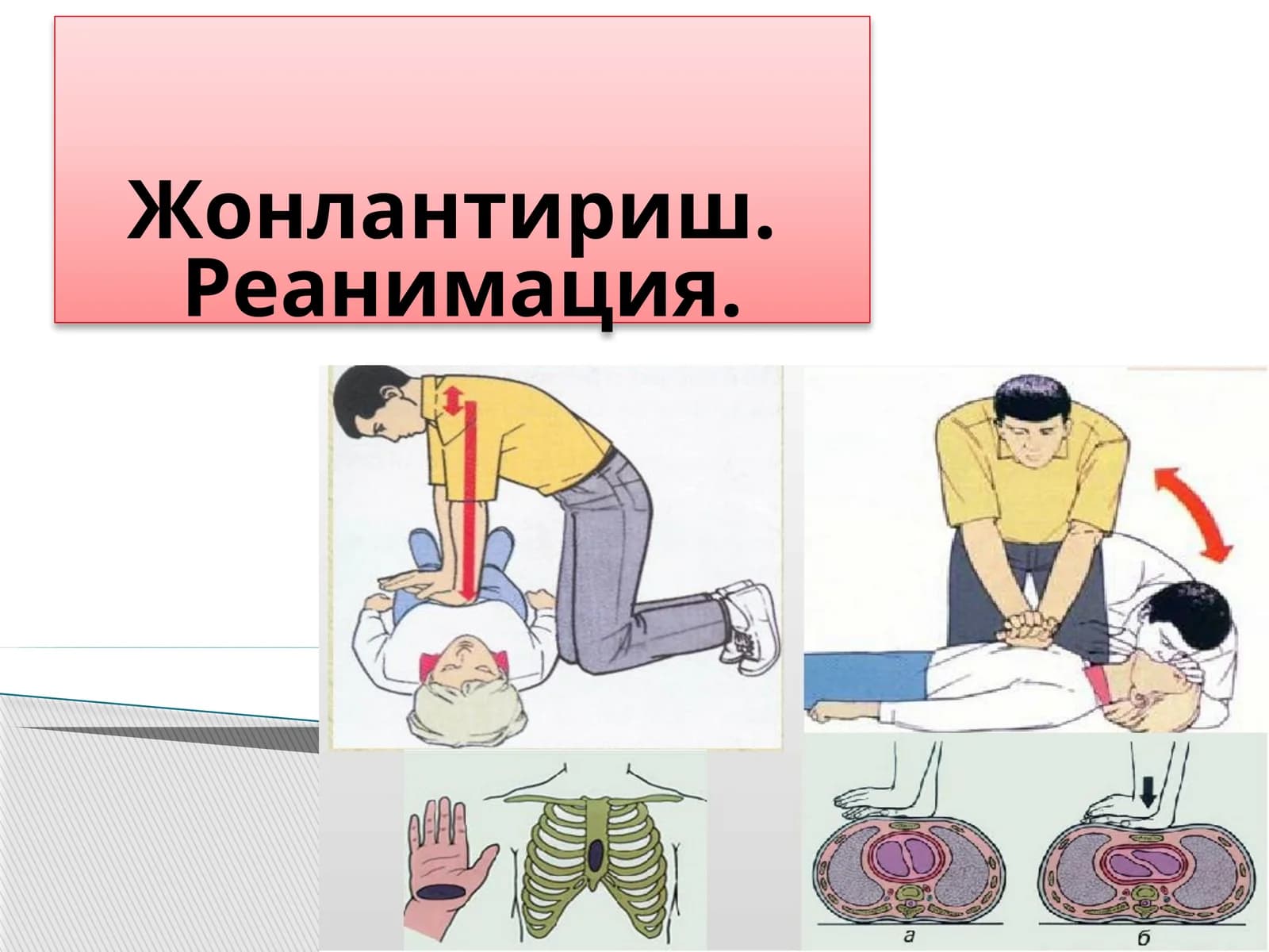 Жонлантириш. Реанимация
