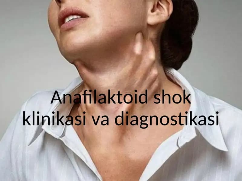 Anafilaktoid shok klinikasi  va diagnostikasi