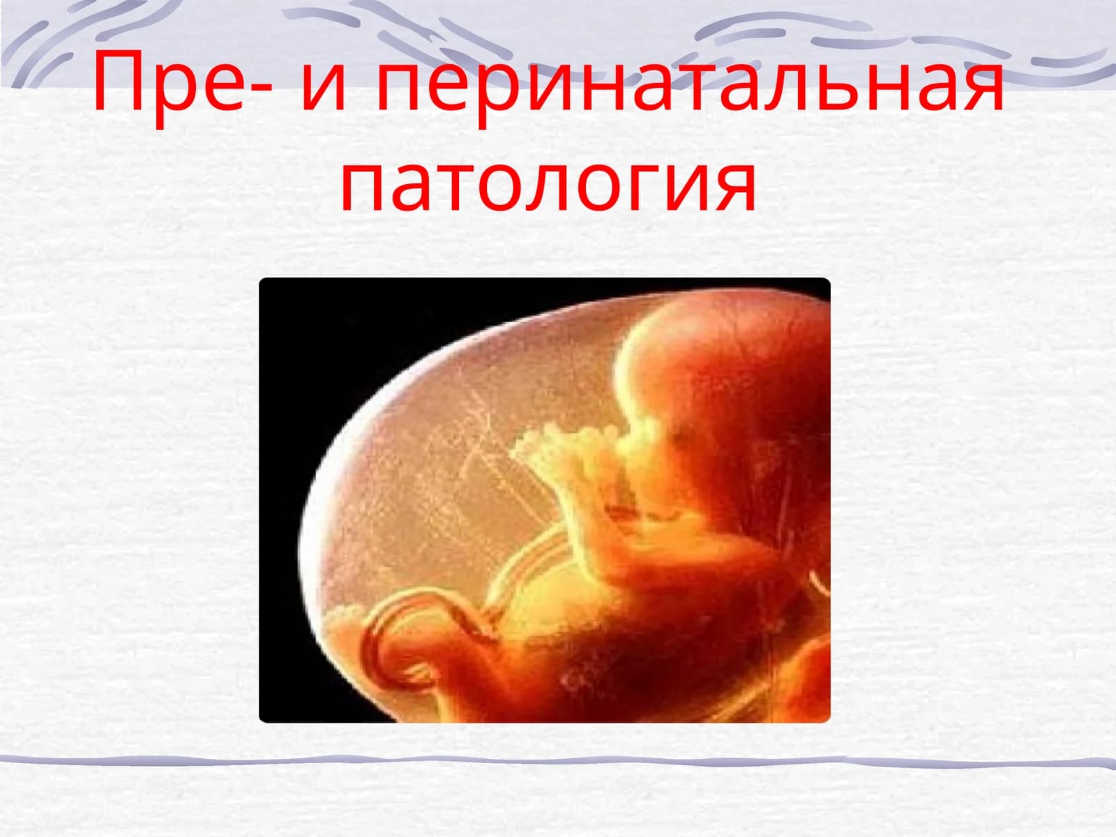 Пре- и перинатальная патология