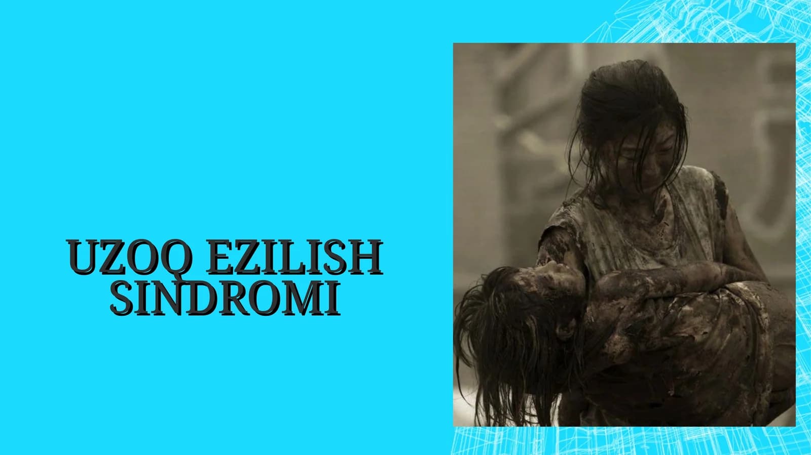 UZOQ EZILISH SINDROMI