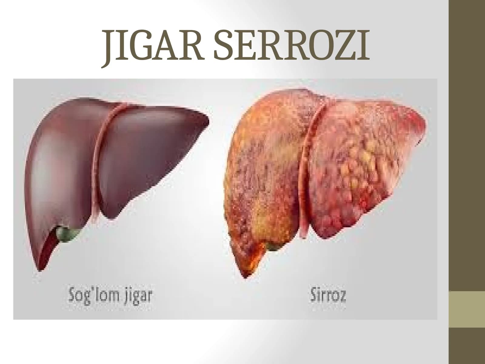 JIGAR SERROZI