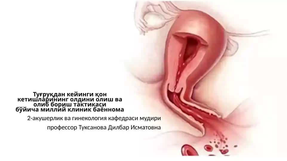 Milii klinik bayonnoma - Tuğruqdan keyingi qon ketishlarining oldini oliş va olib borish taktikasi bo'yĭicha