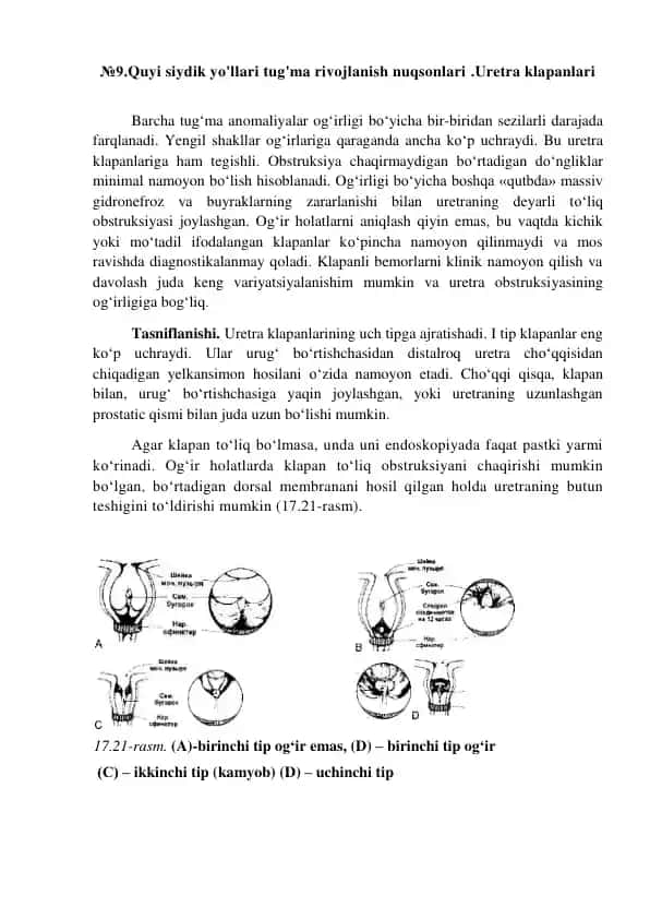 Quyi siydik yo'llari tug'ma rivojlanish nuqsonlari Uretra klapanlari