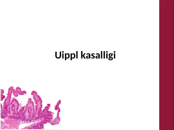 Whipple kasalligi