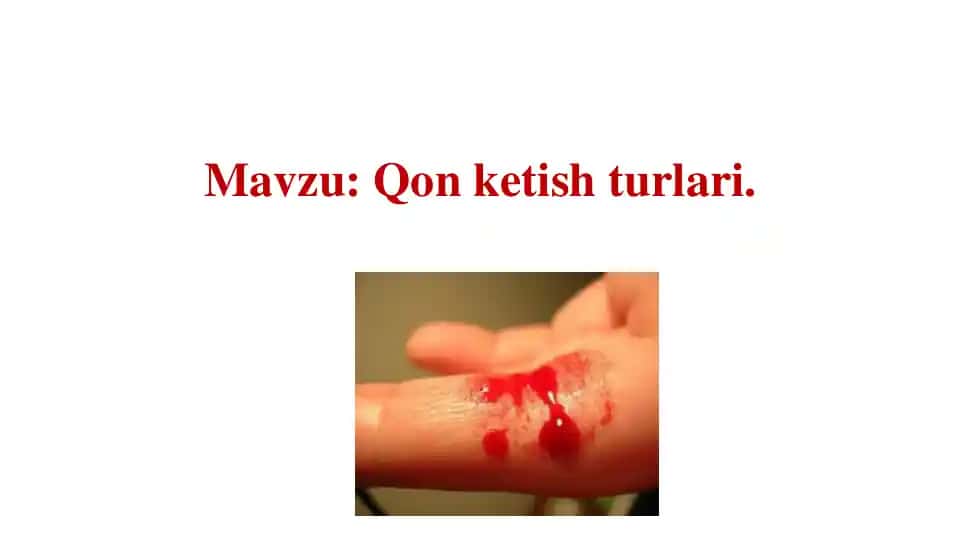 Qon ketish turlari