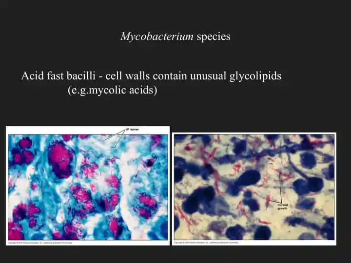 Mycobacterium species