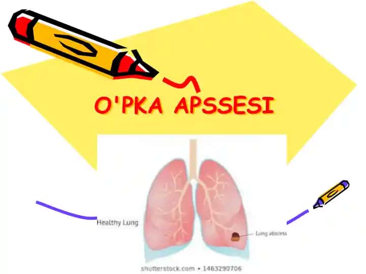 O'PKA APSSESI