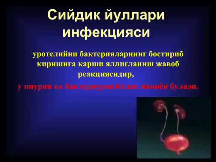 Сийдик йуллари инфекцияси