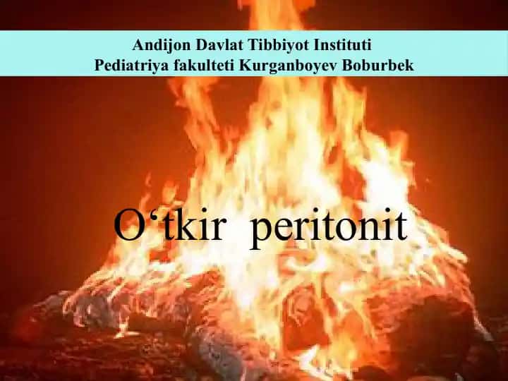 O‘tkir peritonit
