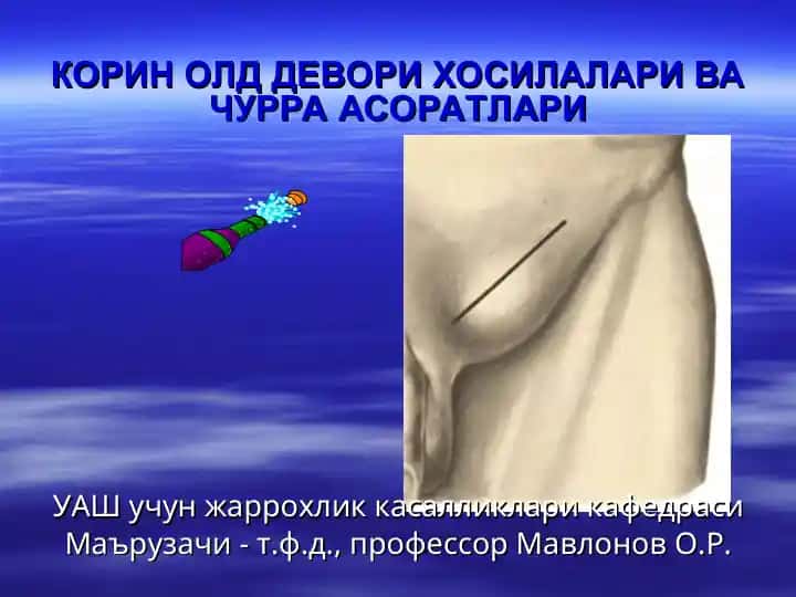 КОРИН ОЛД ДЕВОРИ ХОСИЛАЛАРИ ВА ЧУРРА АСОРАТЛАРИ