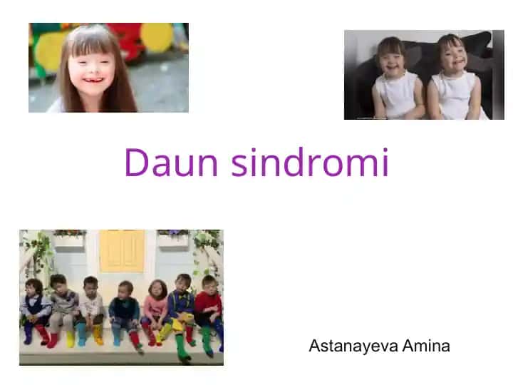 Daun sindromi