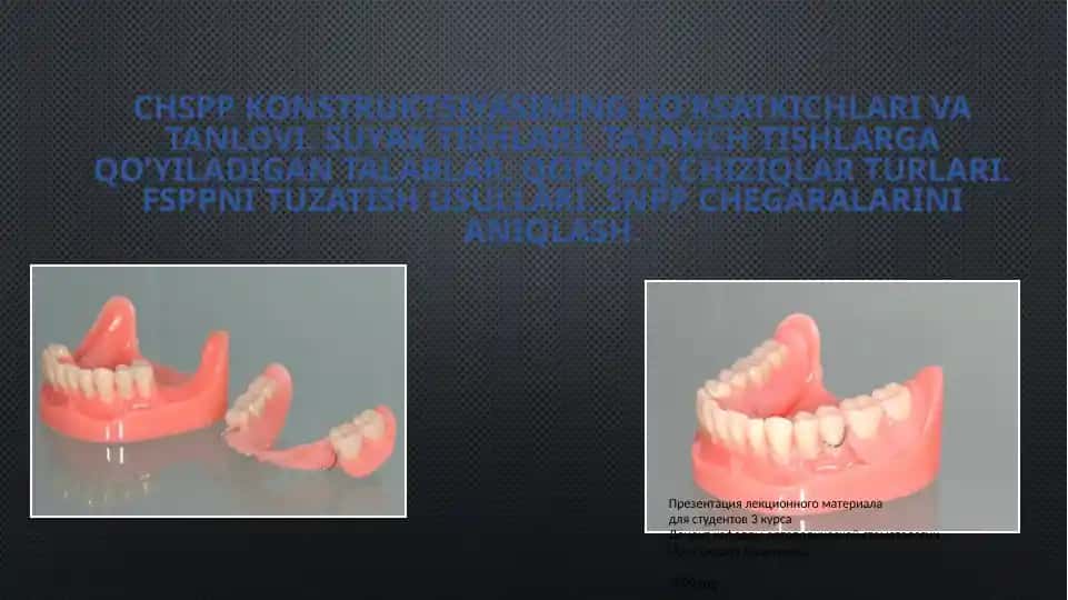 ChSPP konstruktsiyasining ko’rsatkichlari va tanlovi