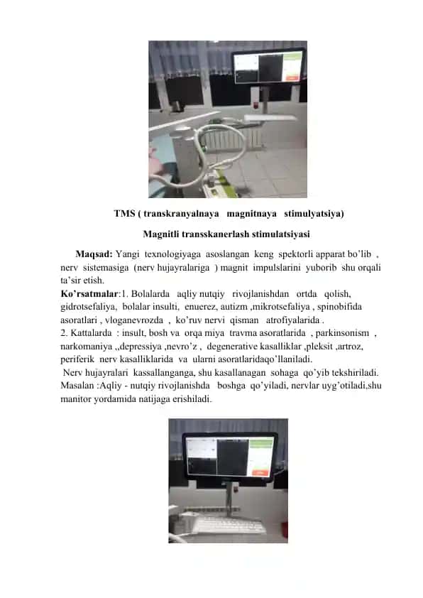 TMS (Transkranyalnaya Magnitnaya Stimulyatsiya)