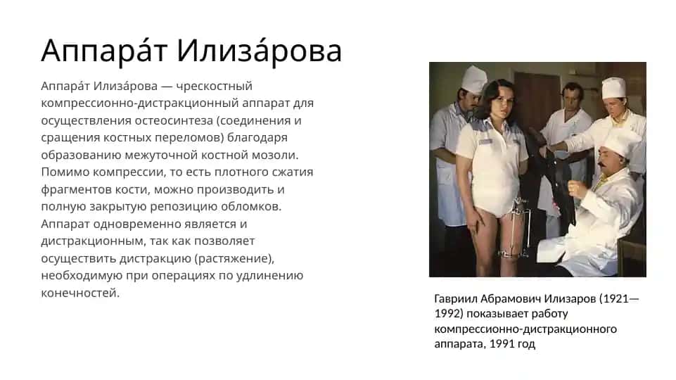 Аппарат Илизарова