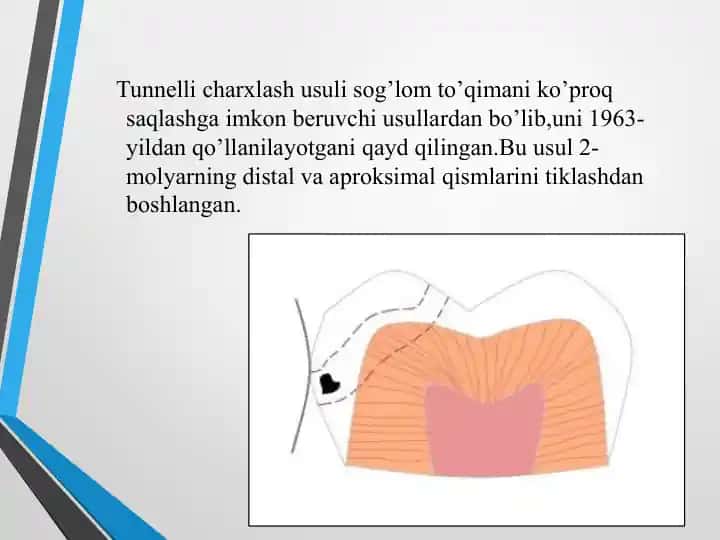 Tunnellicharxlash usuli