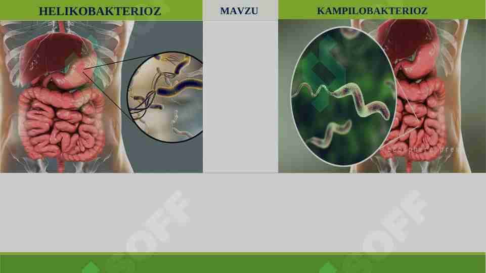 KAMPILOBAKTERIOZ. HELIKOBAKTERIOZ. GASTRIT