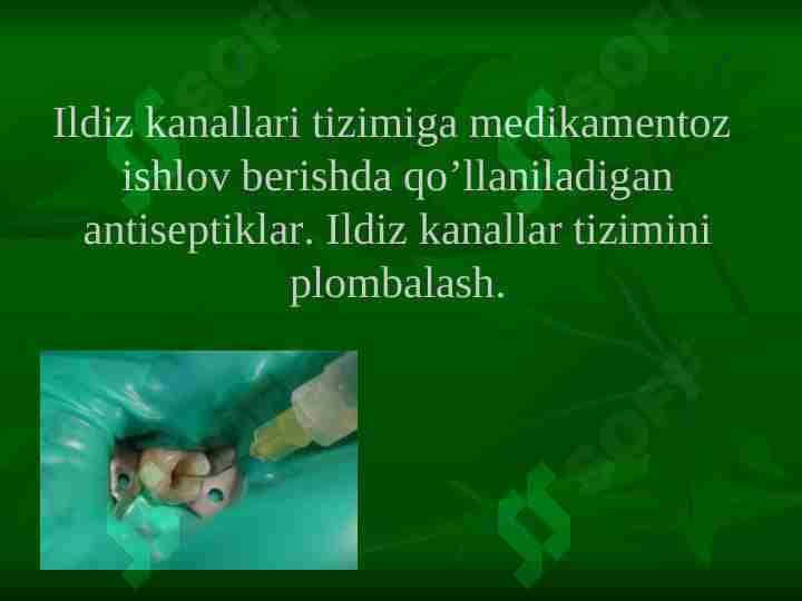 Ildiz kanallari tizimiga medikamentoz ishlov berishda qo’llaniladigan antiseptiklar. Ildiz kanallar tizimini plombalash.