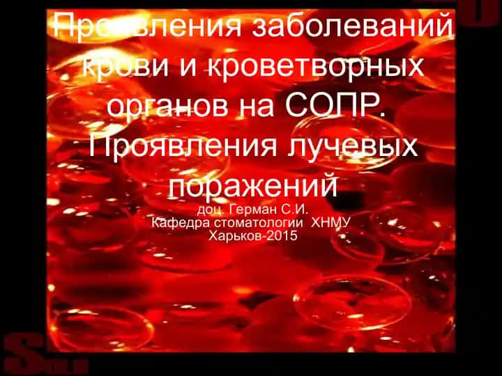 Проявления заболеваний крови и кроветворных органов на СОПР