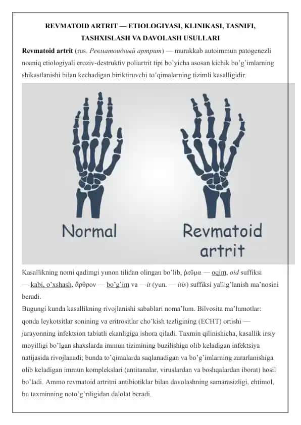 Revmatoid artrit