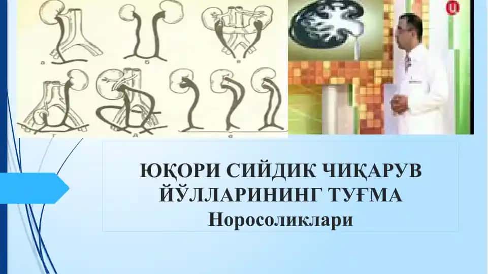 Юқори сийдик чиқариш йўллари норасоликлари