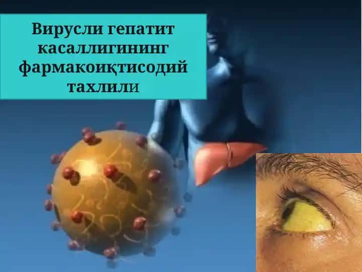 Вирусные гепатиты (ВГ) – группа хронических неоднородных антропонозных заболеваний