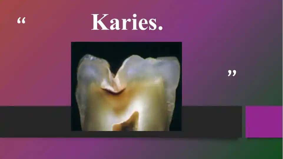 Karies