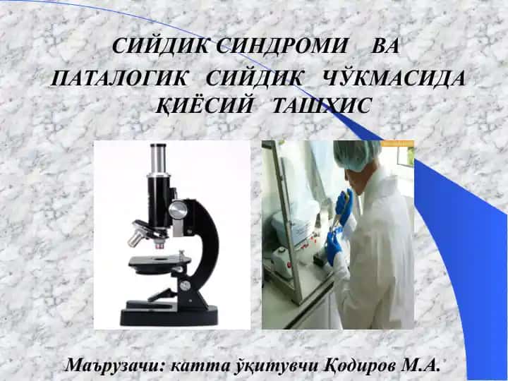 Сийдик синдроми ва патологик сийдик чўкмасида қиёсий ташхис