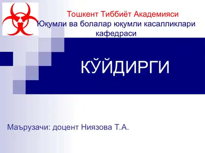 КЎЙДИРГИ