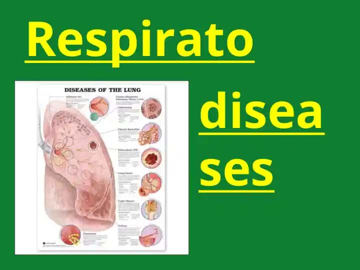 Respiratory Diseases