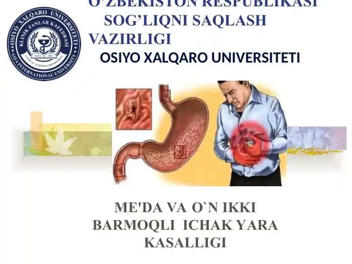 Me'da Vao`n Ikkibarmoqli Ichak Yarakasalligi