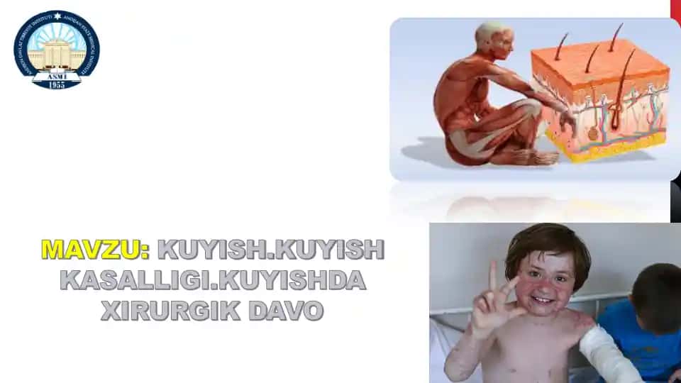 Kuyishlar va Ularga Iqtisodiy Ta'sir