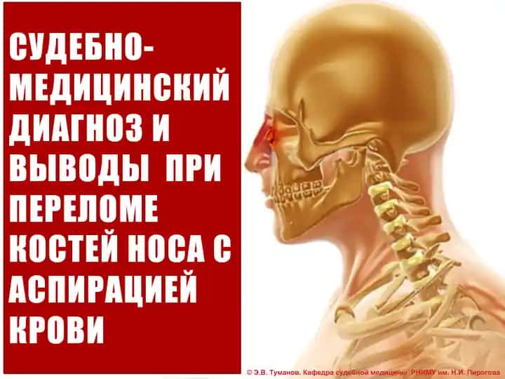 Sudebno-meditsinskiy diagnos i vyvody pri perelome kostey nosa s aspiratsiey krovi