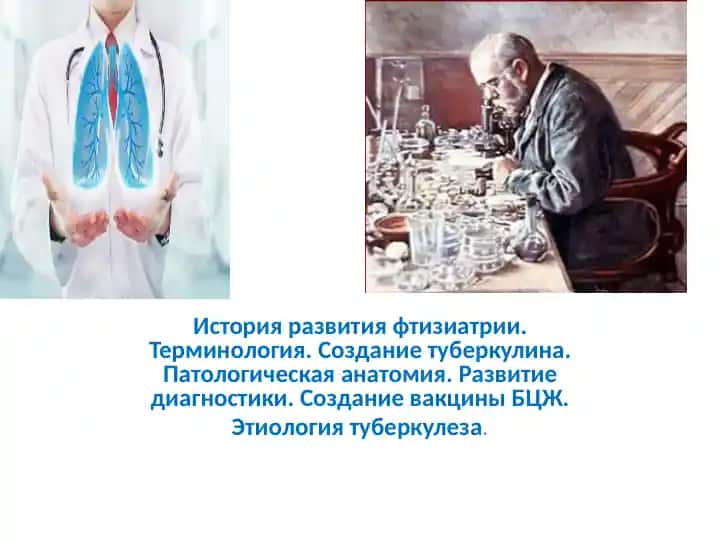 История развития фтизиатрии