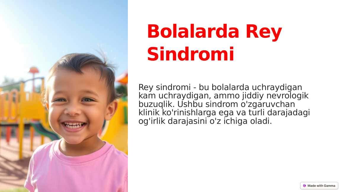 Bolalarda Rey sindromi ppt
