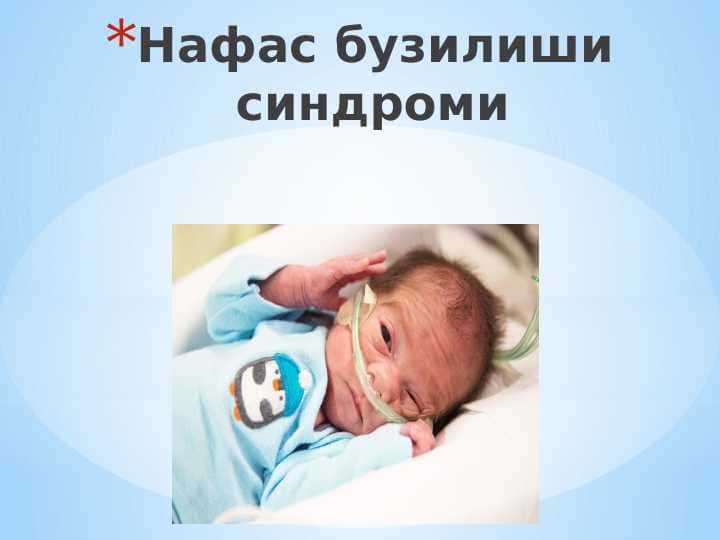 Nafas buzulish sindromi ppt