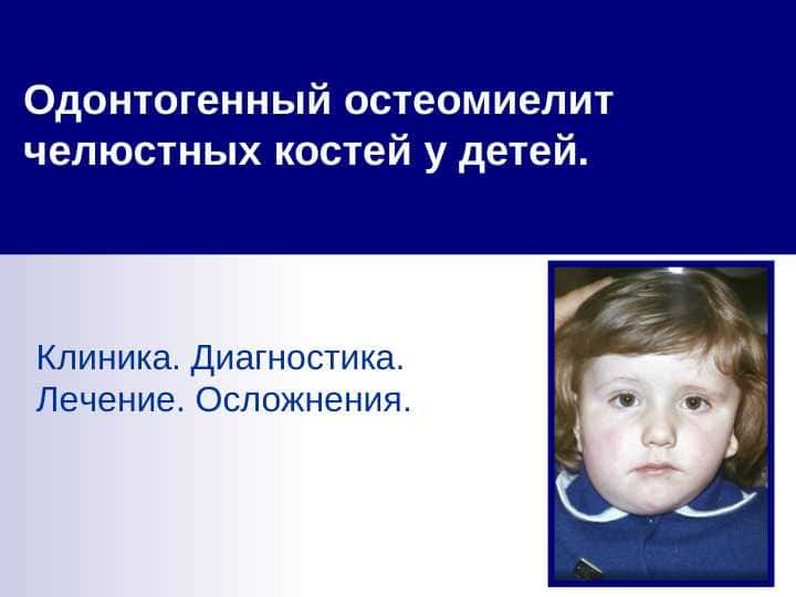 Одонтогенный остеомиелит челюстных костей у детей. Odontogen osteomiyelit. Tasnifi, klinikasi, tashxisi va davolash. Asoratlar Одонтогенный остеомиелит. Классификация, клиника, диагностика и лечение. Осложнения 76394