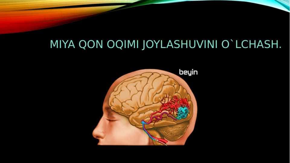 MIYA QON OQIMI JOYLASHUVINI O`LCHASH