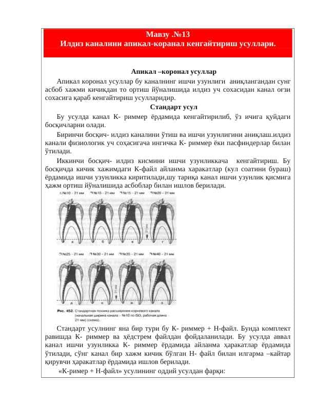 Илдиз каналини апикал-коранал кенгайтириш усуллари.