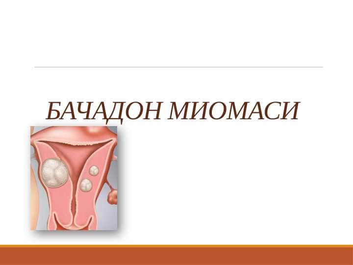 Bachadon miomasi