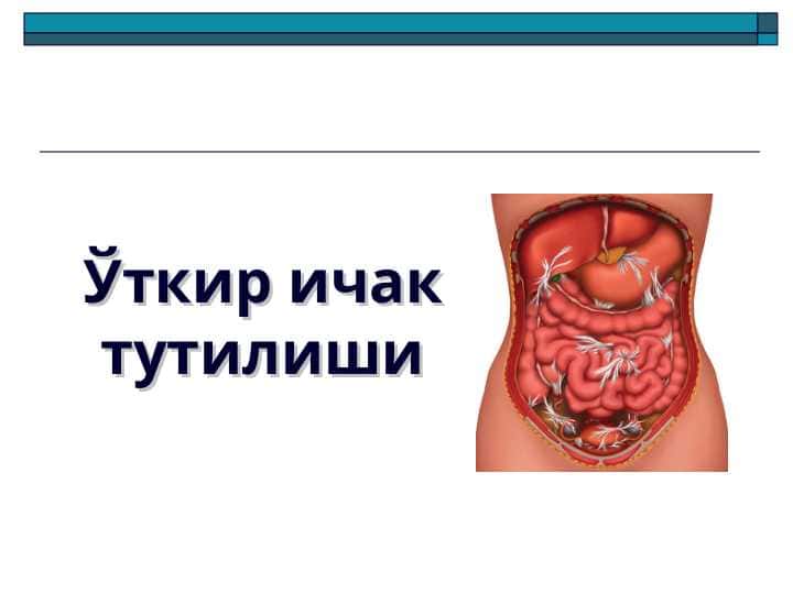O`TKIR ICHAK TUTILISHI